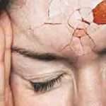 Що робити, якщо головний біль застала зненацька