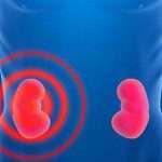 Лікування гидрокаликоза нирок народними засобами