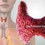 Як лікувати щитовидку народними засобами