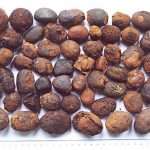 Жовчнокамяна хвороба