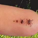 Укус кліща — перша допомога, наслідки, профілактика