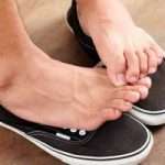 Народні засоби від грибка шкіри