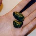 Народні засоби від каменів у жовчному міхурі