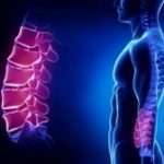 Народні засоби від поперекового остеохондрозу