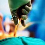 Харчування після видалення жовчного