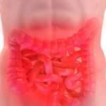 СРК (синдром подразненого кишечнику) і його лікування засобами народної медицини