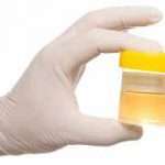 Як вилікувати захворювання лор-уриною