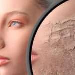 Перша допомога збезводненої шкірі