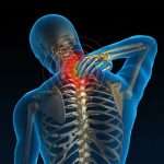 Остеохондроз — хвороба століття