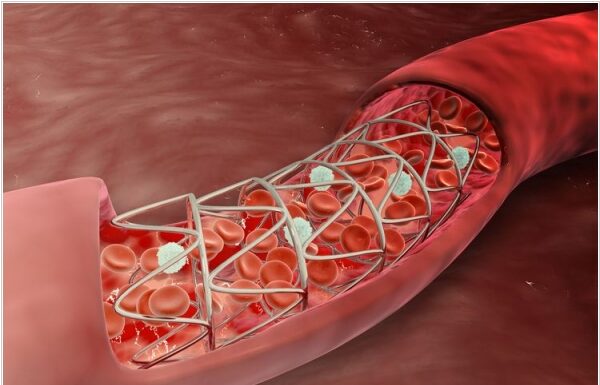 Чи можливо зазирнути у судини?