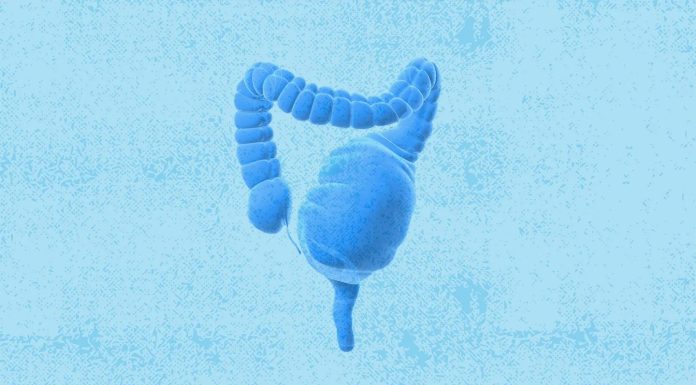 Токсичний Мегаколон: симптоми, причини, діагностика, лікування та профілактика