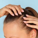 Розуміння індексу SALT для гніздової алопеції: що він вимірює та чому це важливо