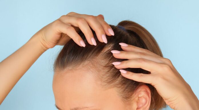 Розуміння індексу SALT для гніздової алопеції: що він вимірює та чому це важливо