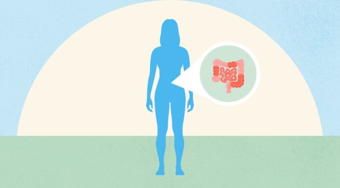 Розуміння «тихої хвороби Крона»: коли запалення приховане