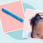 Препарати GLP-1 Пов’язані з Тимчасовим Витонченням Волосся: Що Повинні Знати Пацієнти