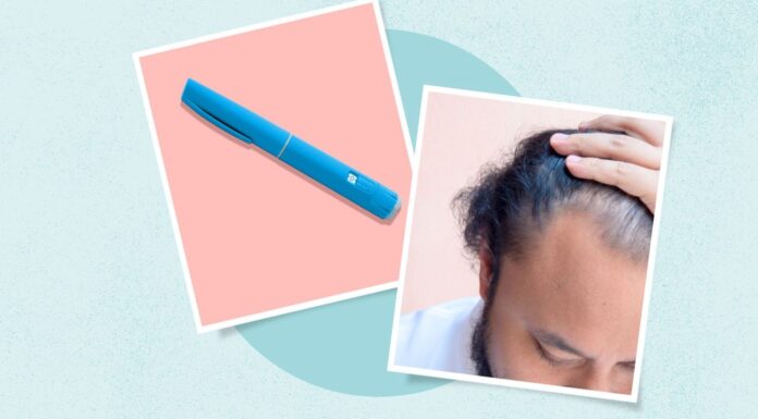Препарати GLP-1 Пов’язані з Тимчасовим Витонченням Волосся: Що Повинні Знати Пацієнти