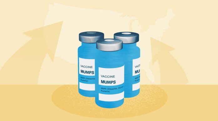 Відродження Свинки: Чому зростає кількість випадків і що вам потрібно знати