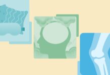 За пределами видимого: как справиться со скрытым бременем акромегалии