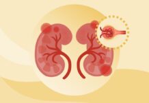 Your Kidneys Are Getting It Wrong (Literally)